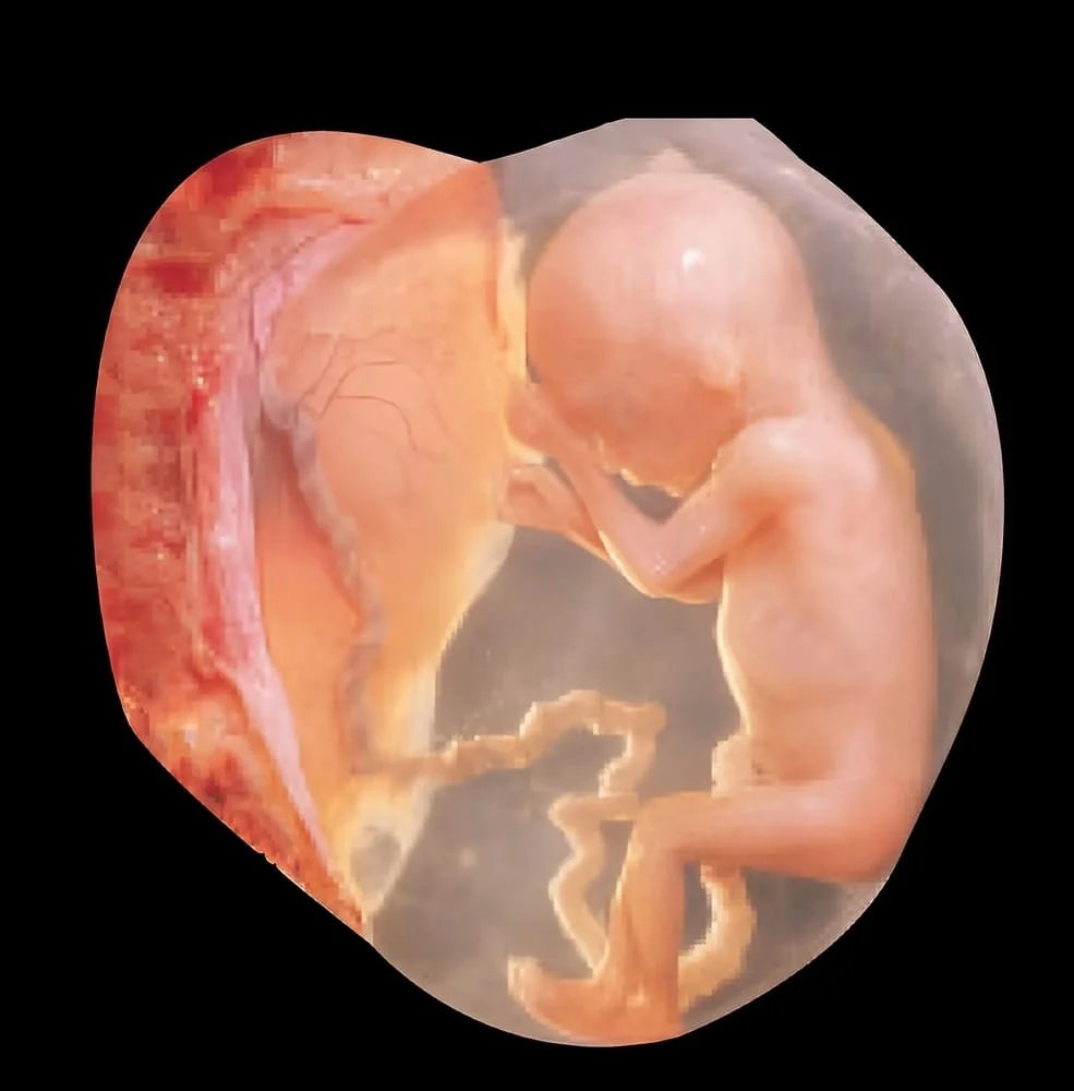 Corioamniotita: cauze, simptome, tratament