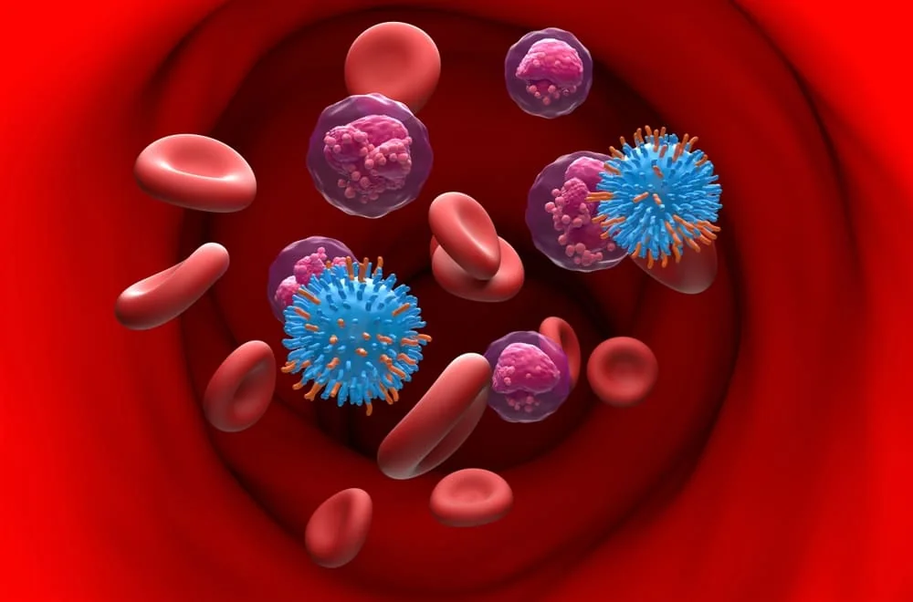 Leucemie limfoblastica acuta: cauze, simptome, tratament