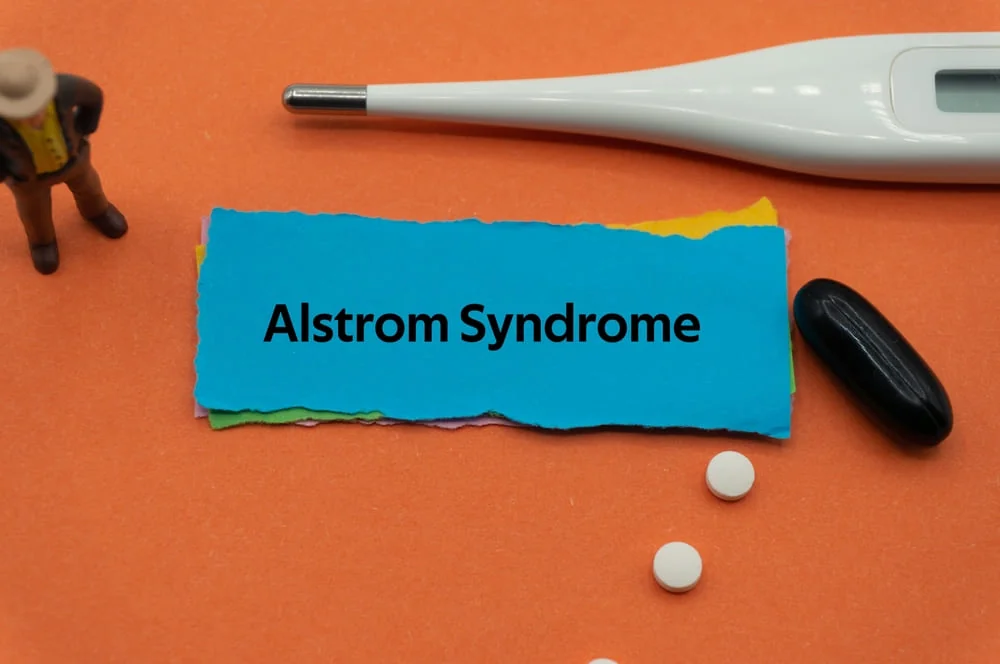 Sindrom Alstrom: cauze, simptome, tratament