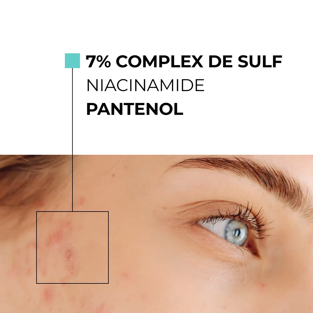 Skinexpert by Dr. Max® Tratament local anti-imperfectiuni AcnePro, 15ml