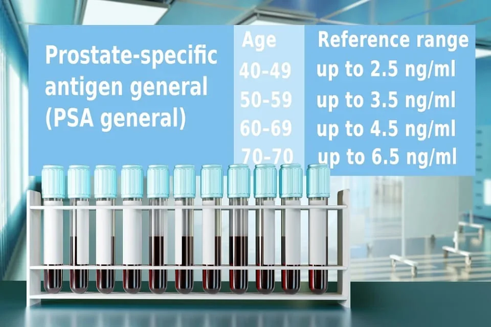 Antigenul Specific Prostatic Antigenul Specific Prostatic