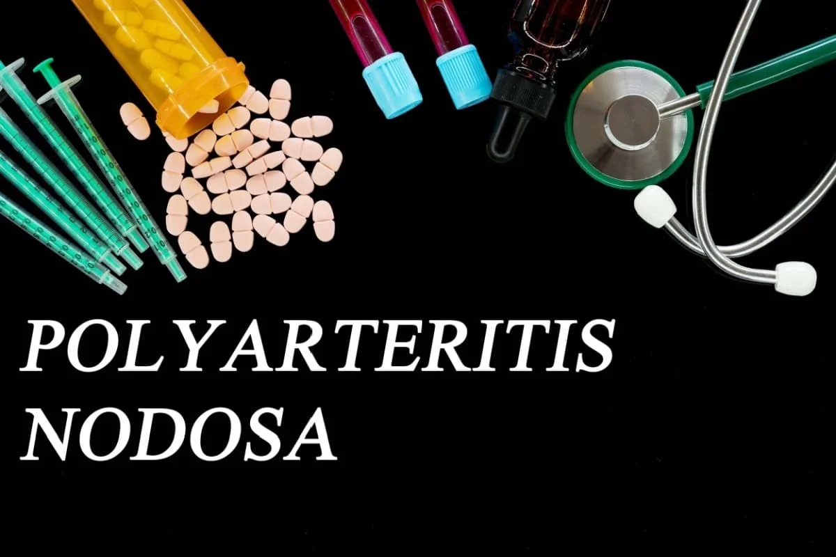 Poliarterita nodoasa: cauze, simptome, tratament