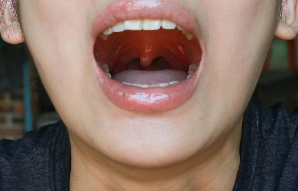 Uvula (omuletul din gat): functii, rol, afectiuni asociate