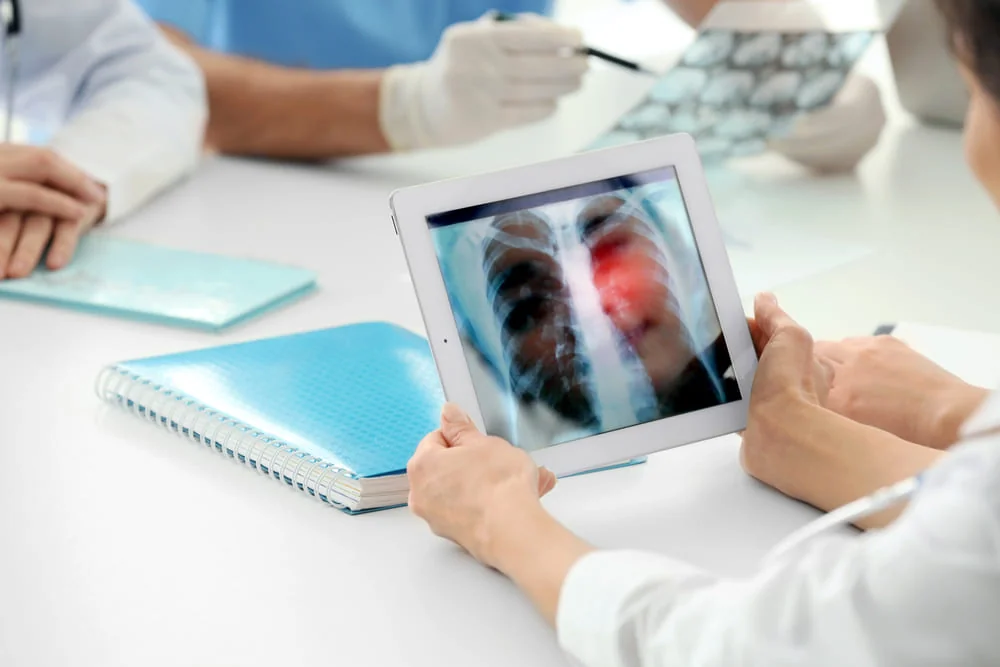 Radiografie Radiografie