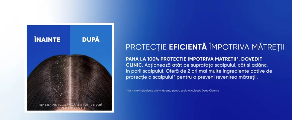 Protectie eficienta impotriva matretii, ilustrata prin comparatia scalpului inainte si dupa utilizarea samponului Head & Shoulders.