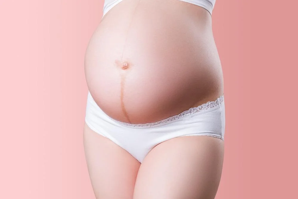 Linea nigra (linia neagra in sarcina): ce este, de ce apare, mituri