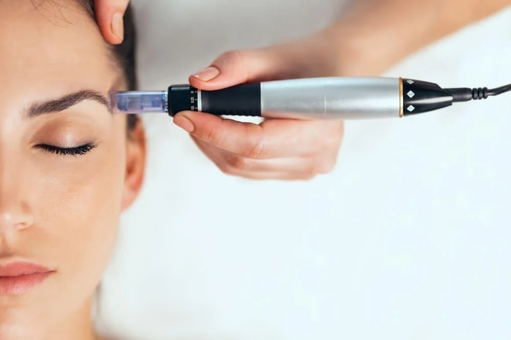 Dermapen: ce este si cum functioneaza