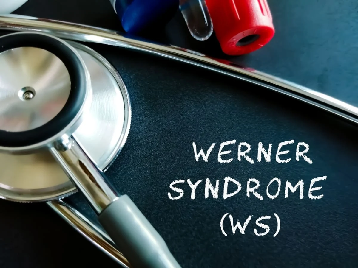 Sindromul Werner: cauze, simptome, tratament si prevenire
