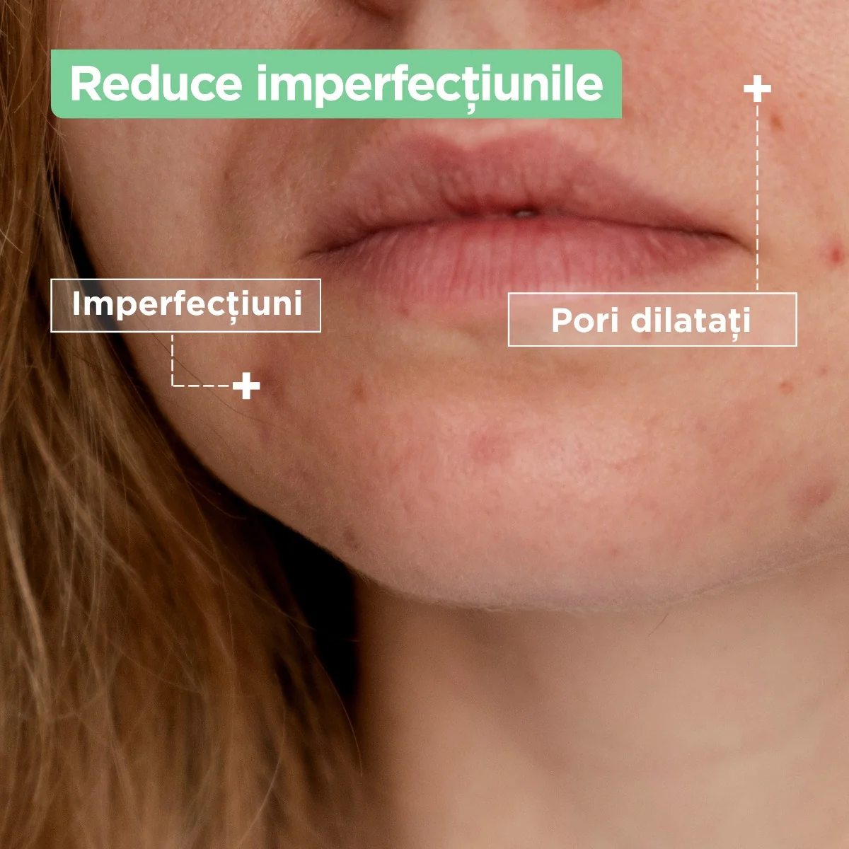 Crema anti-imperfectiuni pentru sensibil, 50ml, Mixa