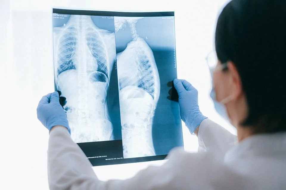 RMN pulmonar RMN pulmonar