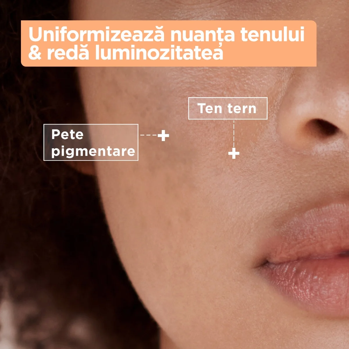 Crema anti-pete pigmentare cu SPF20 pentru tenul sensibil, 50ml, Mixa