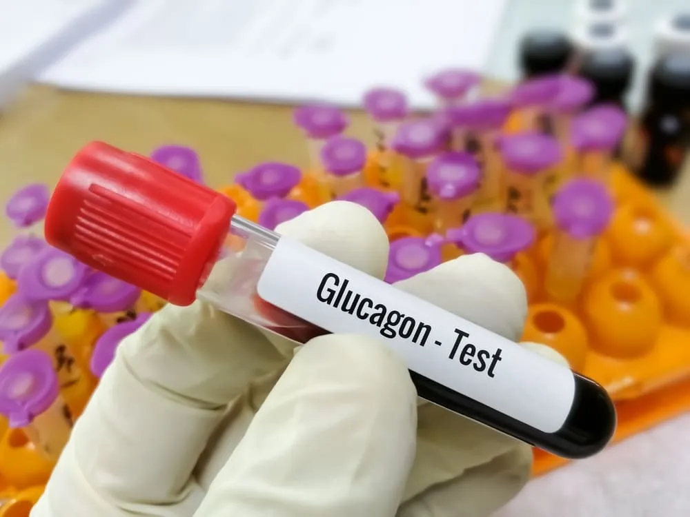 Glucagon - test