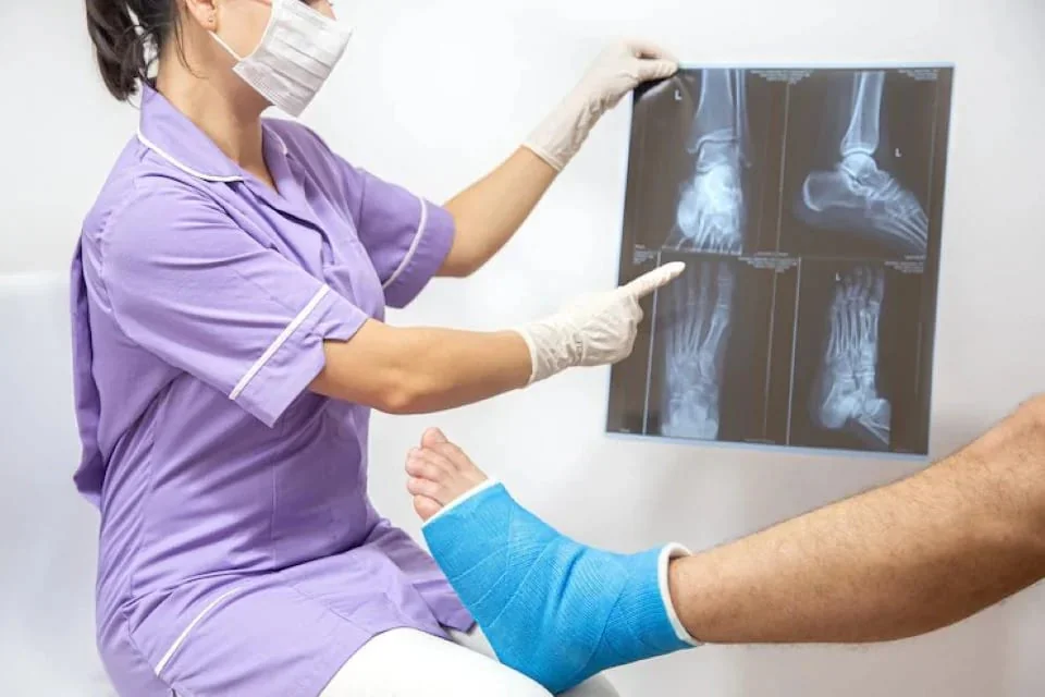 fractura picior fractura picior