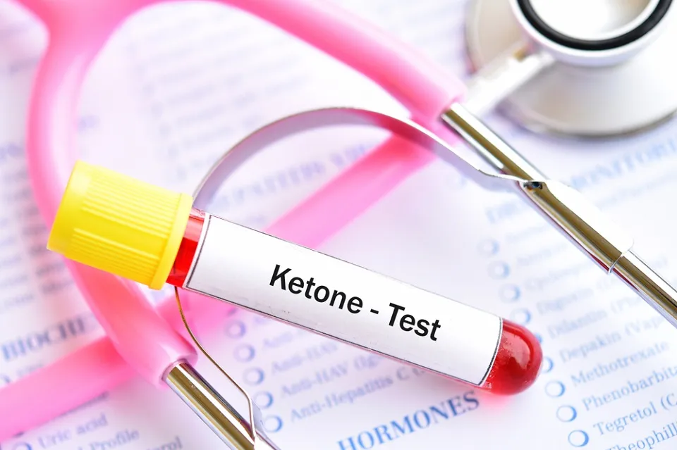 Ketone- Test