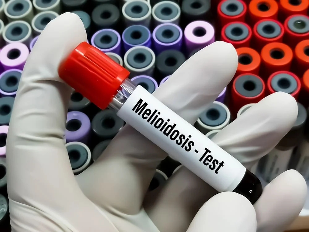 Melioidoza: cauze, simptome, tratament