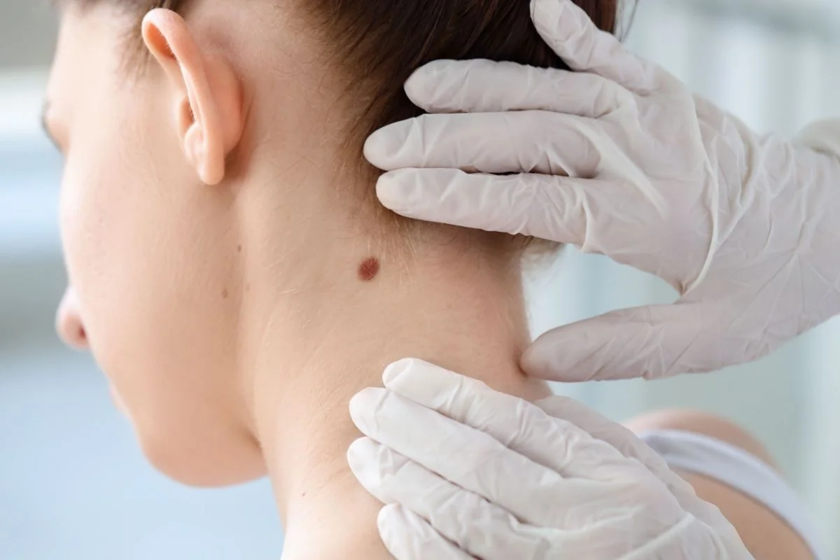Alunite cancerigene: ce trebuie sa stii despre ele