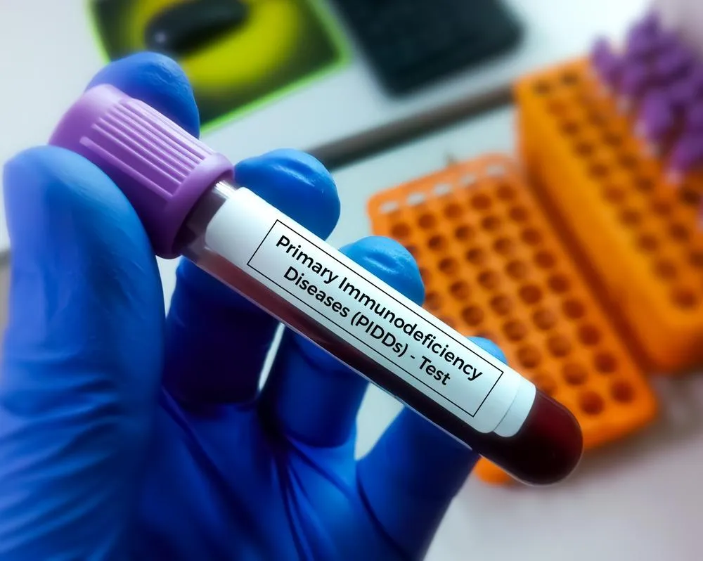 Imunodeficienta primara: cauze, simptome, tratament