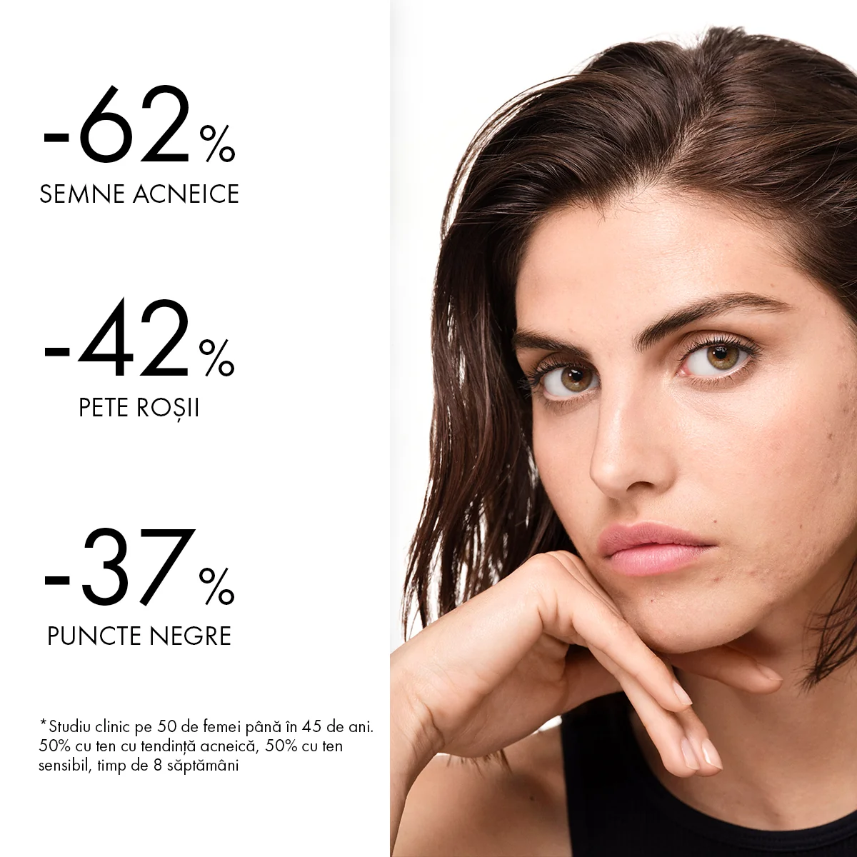 Crema hidratanta cu acid salicilic pentru ten gras cu tendinta acneica Normaderm, 50ml, Vichy