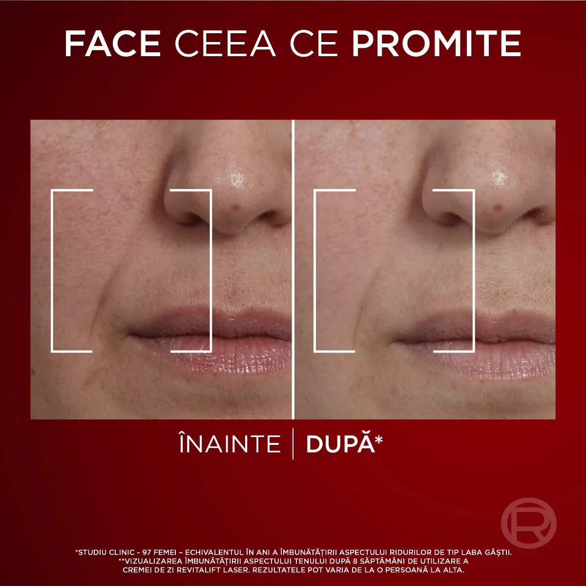 Crema antirid de zi Revitalift Laser cu tripla actiune, 50ml, L'Oreal Paris