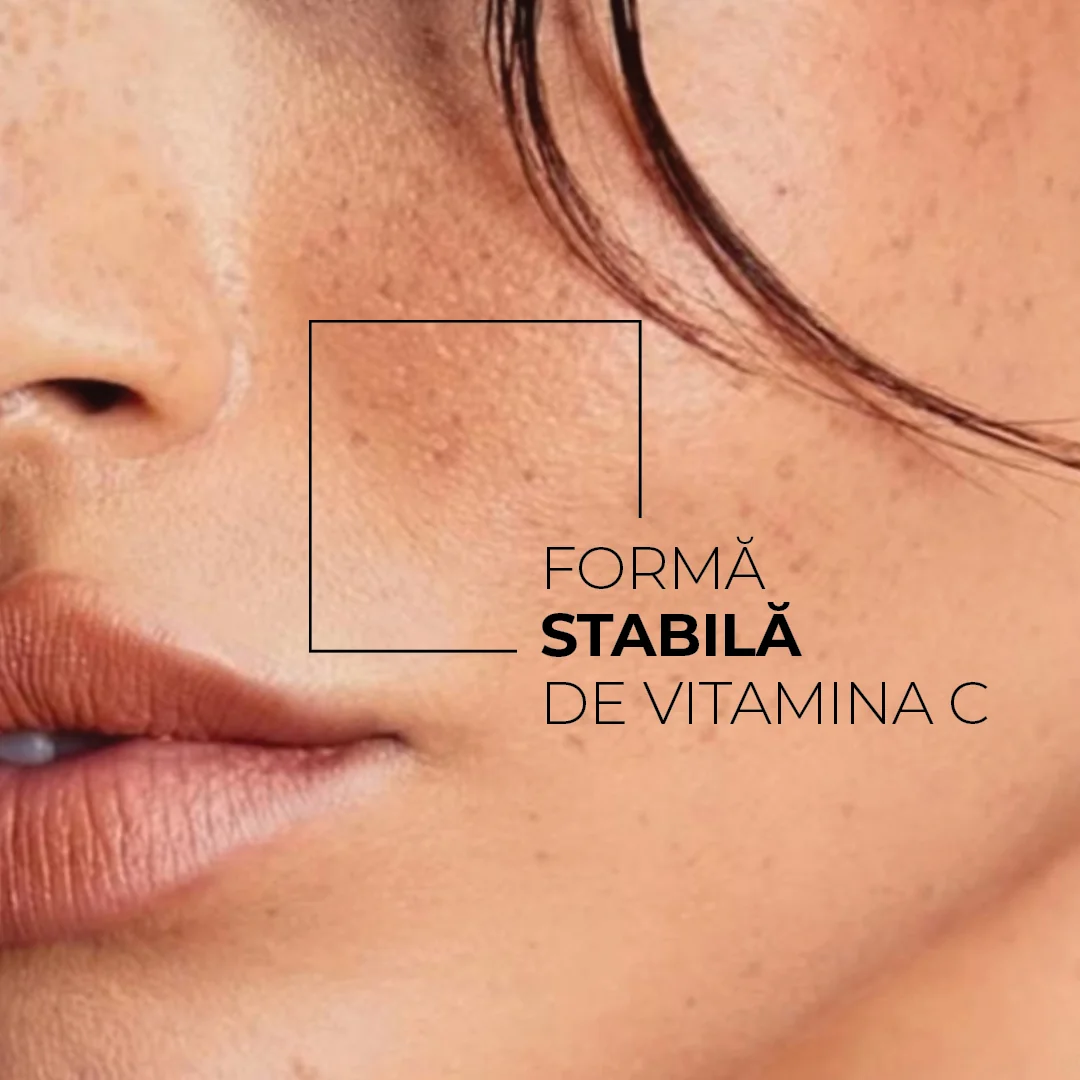 Skinexpert by Dr. Max® Crema de fata pentru luminozitate Spotlight, 50ml