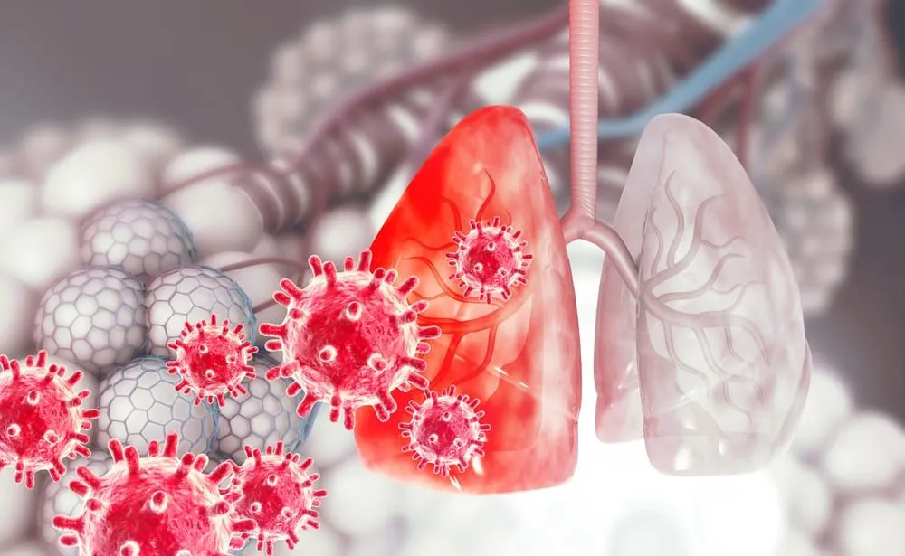 Virus sincitial respirator: ce este si ce trebuie sa stii despre el