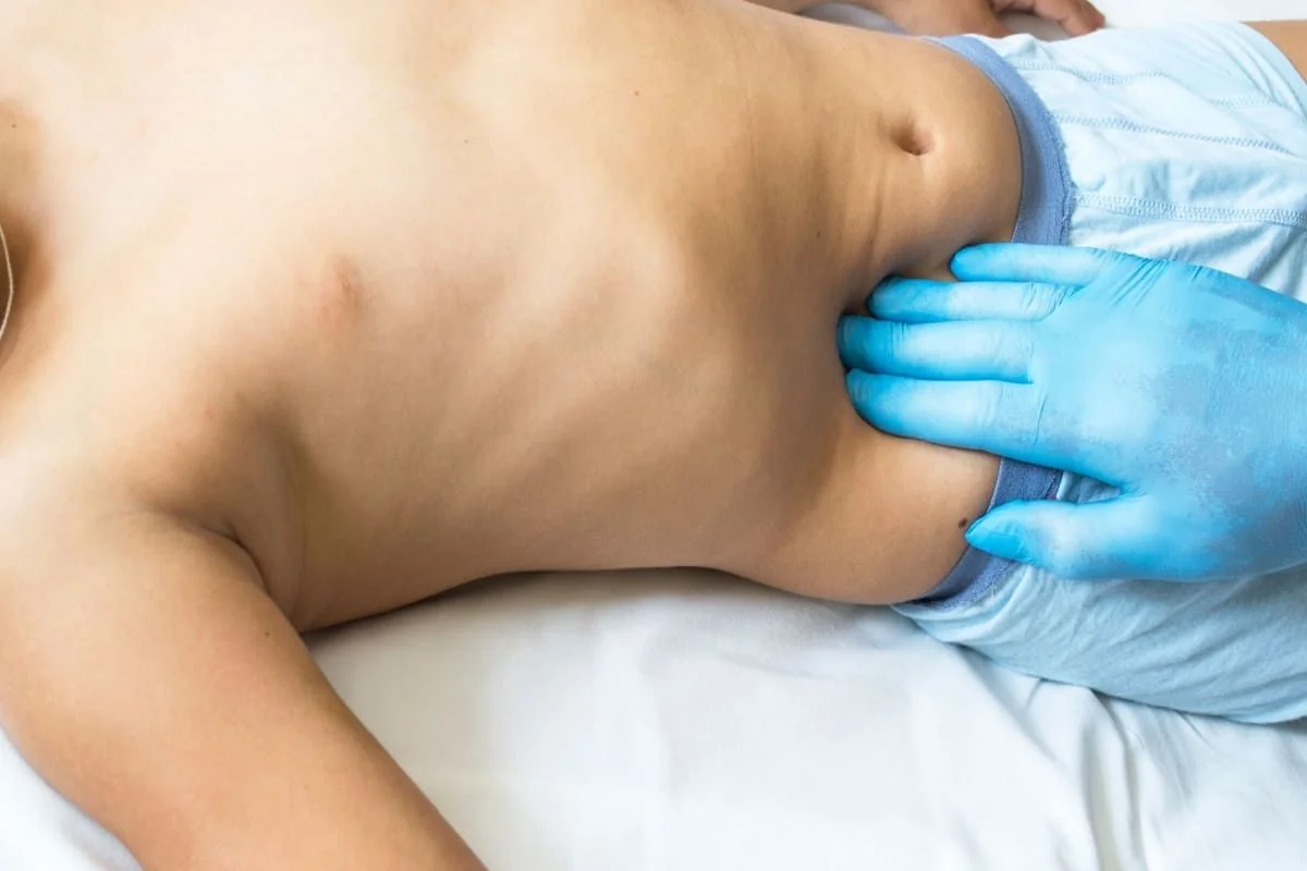 Apendicita la copii: cauze, simptome, tratament