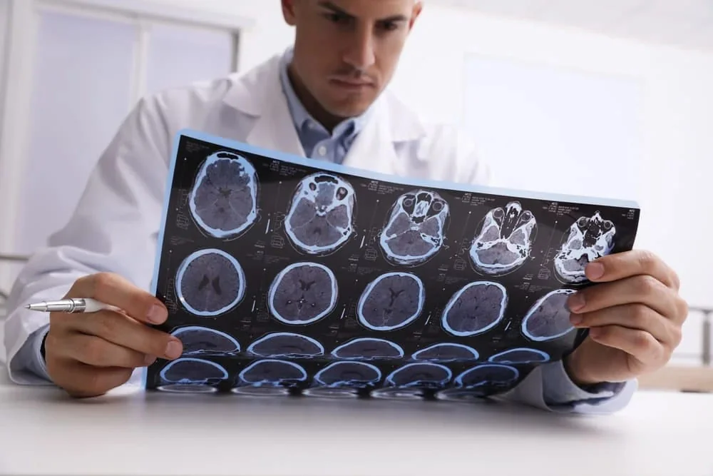 consult medical epilepsie consult medical epilepsie