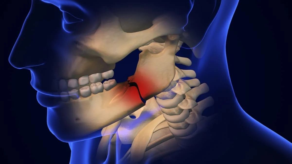 Fractura de mandibula: cauze, simptome, tratament