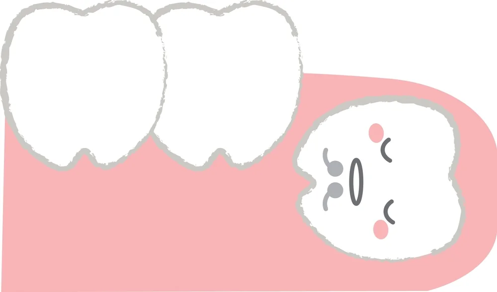 Dinti crescuti in gingie: cauze, simptome si tratament