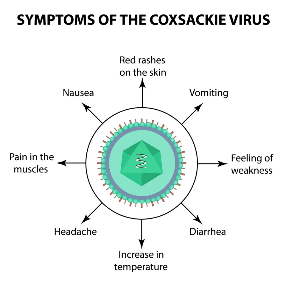 Simptomele virusului Coxsackie