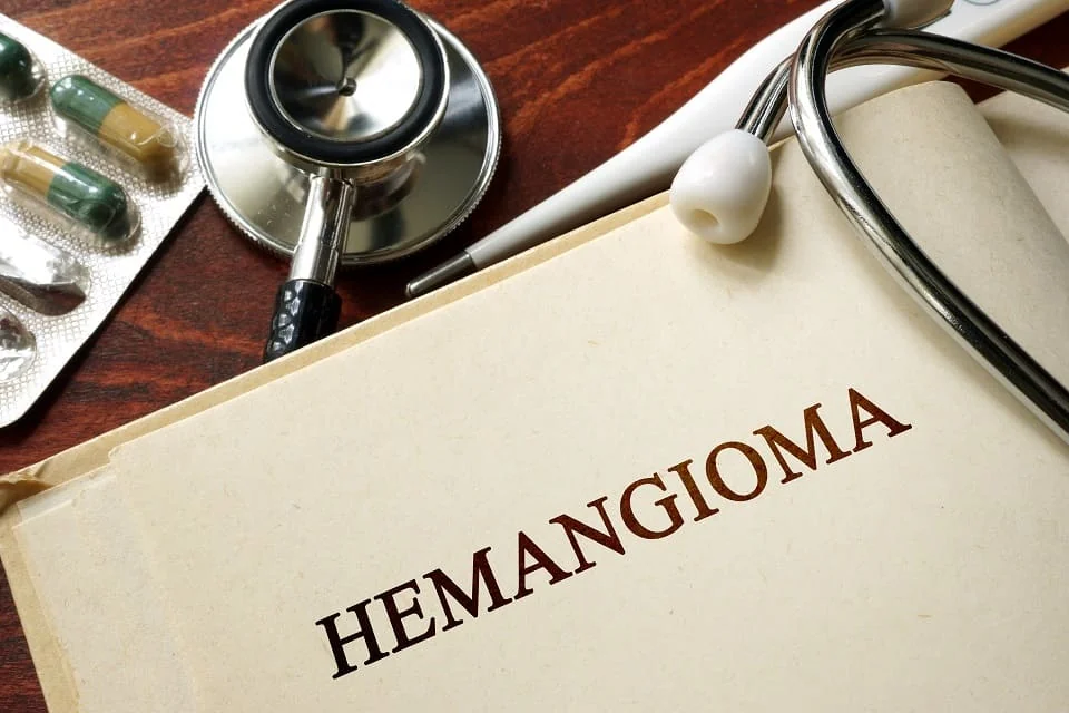 Hemangiom optiuni de tratament Hemangiom optiuni de tratament