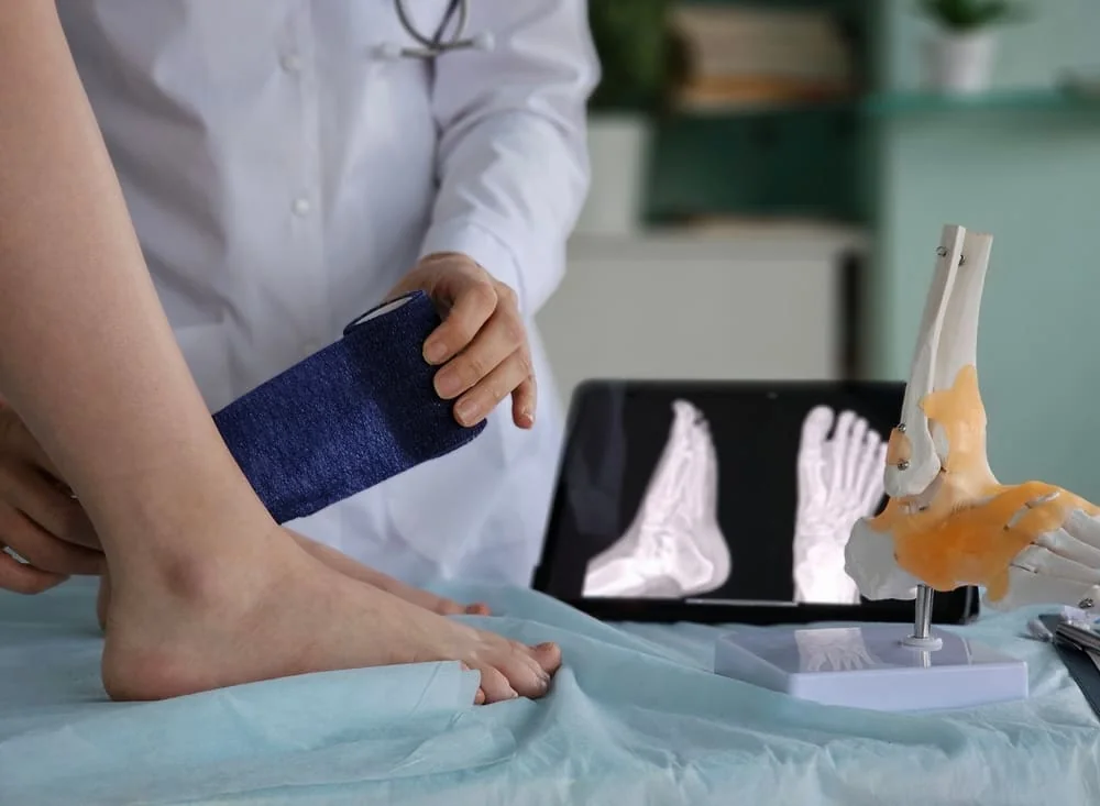 Greseli frecvente in recuperarea dupa entorsa de glezna si cum le eviti