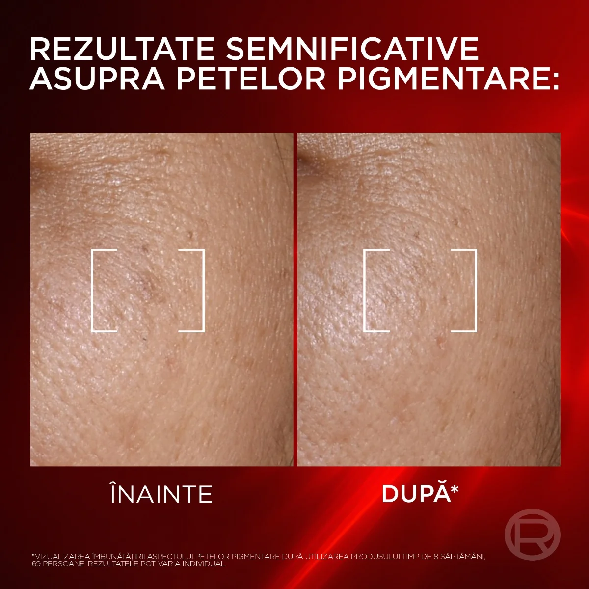 Serum-crema anti-imbatranire Revitalift Laser Melasyl, 50ml, L'Oreal Paris