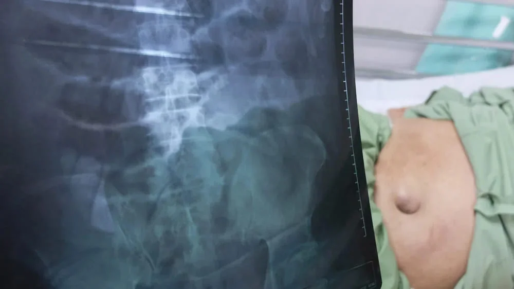 Radiografie