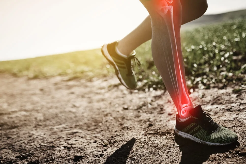Fractura de stres: cauze, simptome, tratament