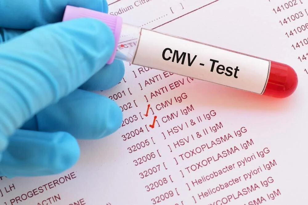 Citomegalovirus test Citomegalovirus test
