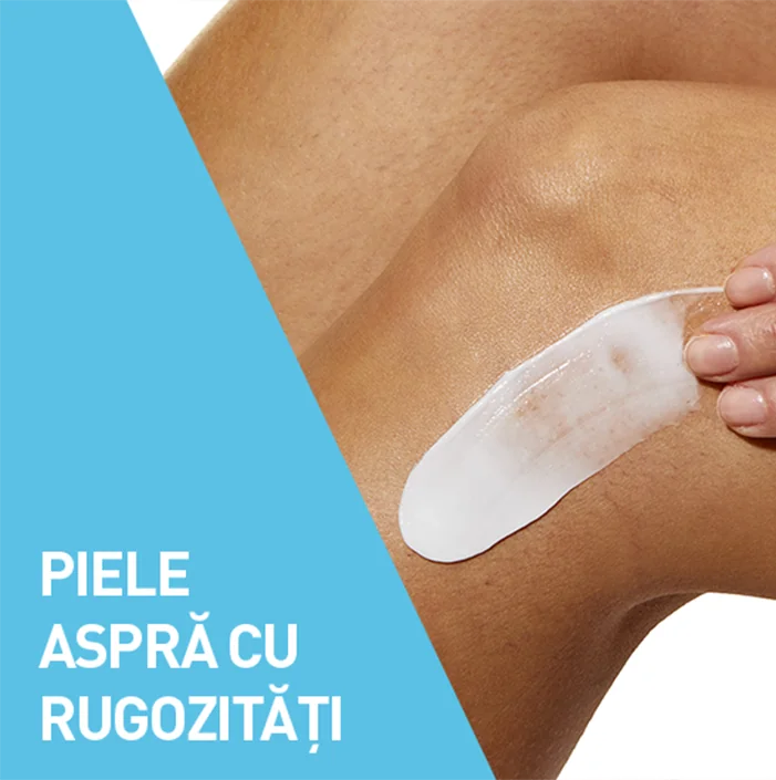 Piele aspra cu rigurozitati Piele aspra cu rigurozitati