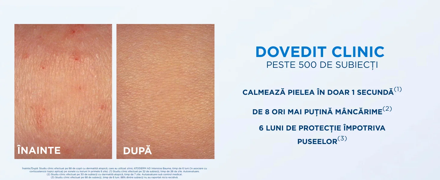 Dovedit clinic peste 500 de subiecti
