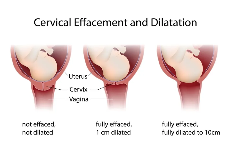 Colul uterin in sarcina