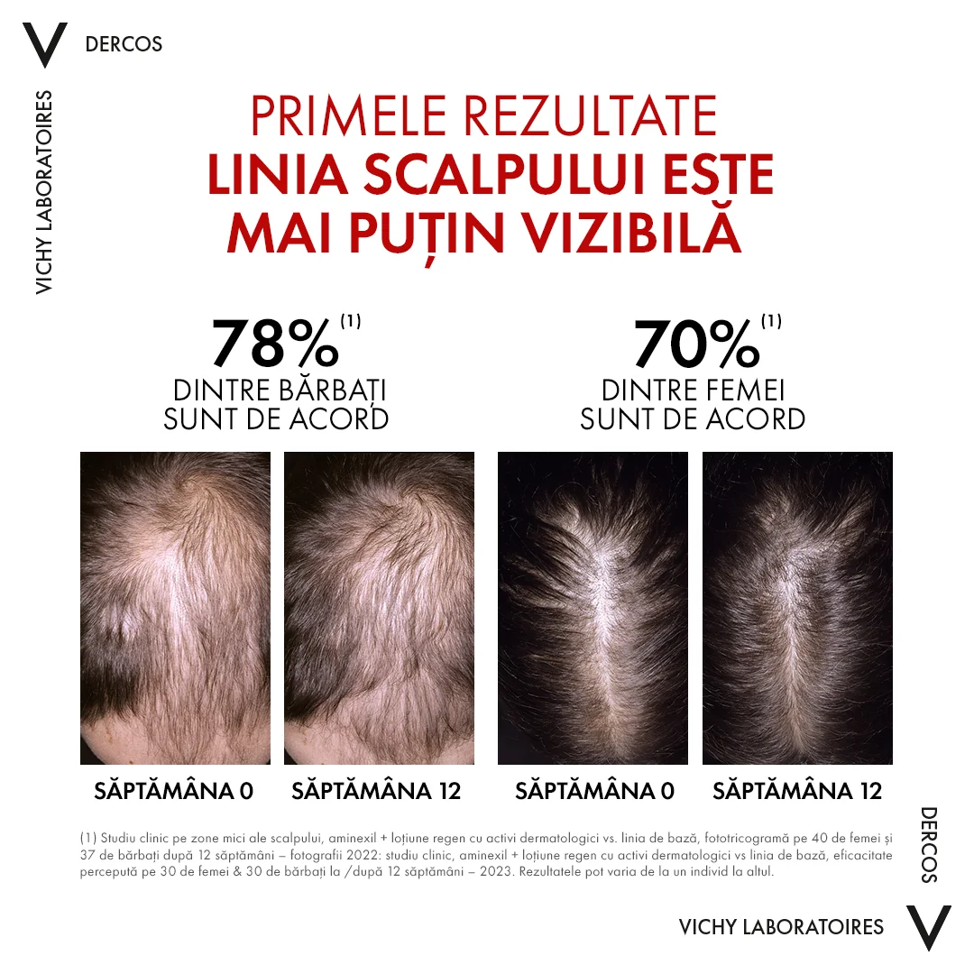 Serum cu efect de regenerare Aminexil Dercos, 100ml, Vichy