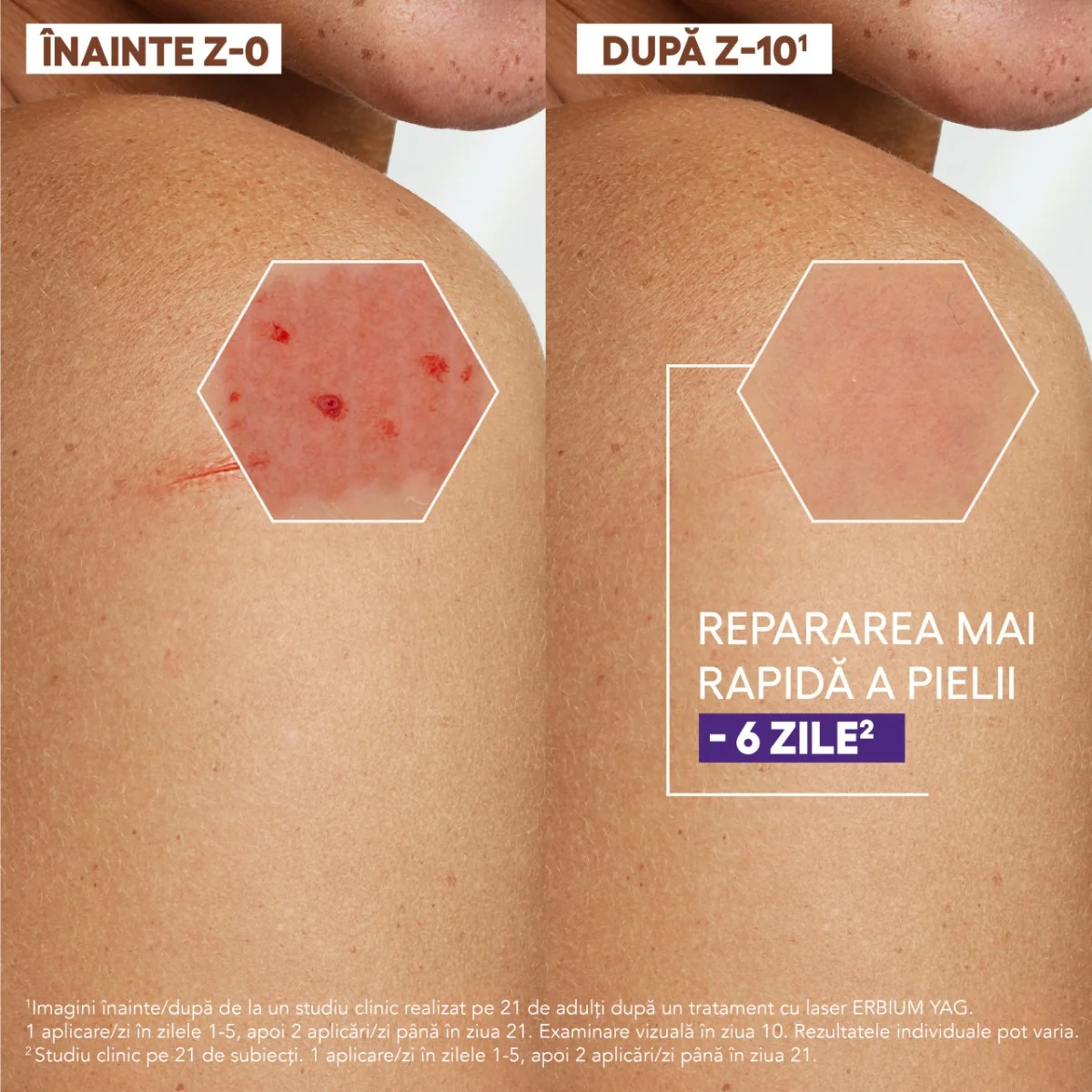 Crema reparatoare pentru pielea deteriorata Epitheliale Ultra Repair, 40ml, A-Derma
