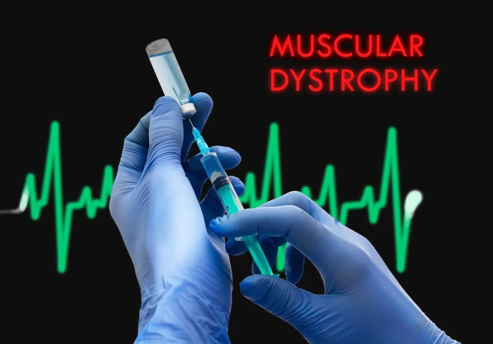 Cum se stabileste diagnosticul de distrofie musculara