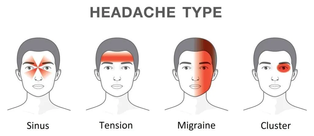 Dureri de cap: Tipuri, cauze si tratament