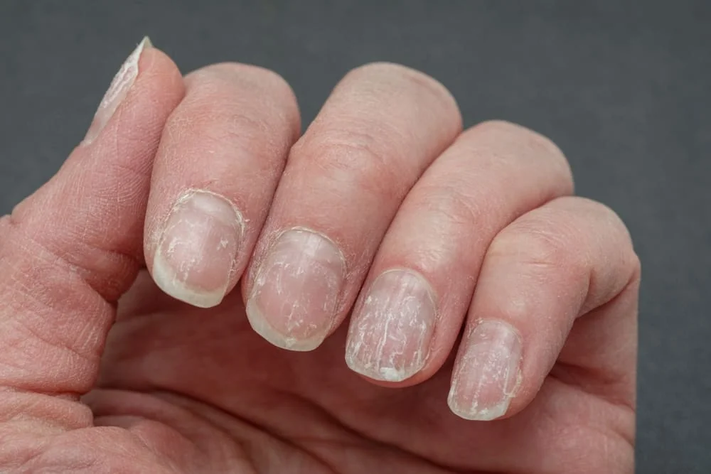 Cum sa iti regenerezi unghiile dupa gel sau lac semi-permanent?