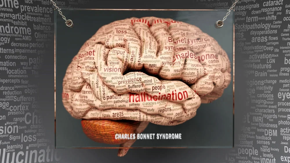 Sindrom Charles Bonnet: cauze, simptome, tratament