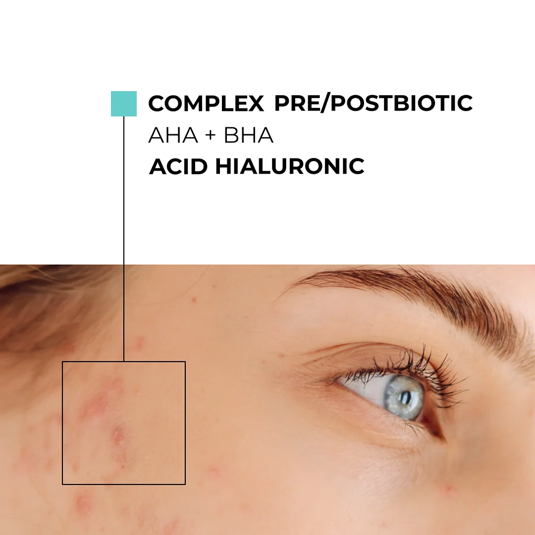 Skinexpert by Dr. Max® Ser anti-imperfectiuni AcnePro, 28ml