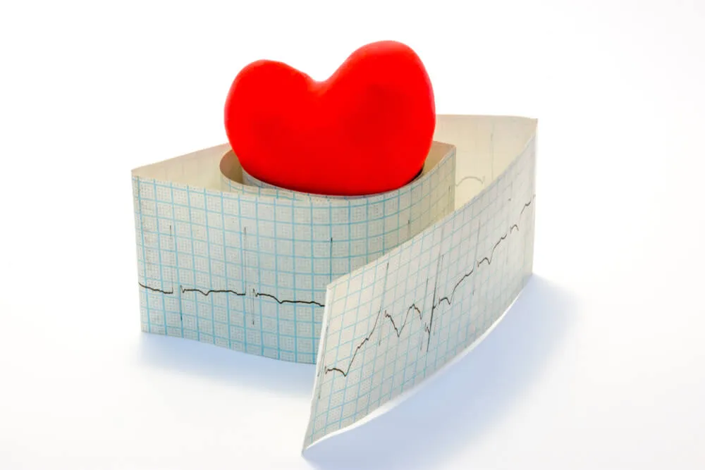 Aritmia cardiaca: tot ce trebuie sa stii despre ea