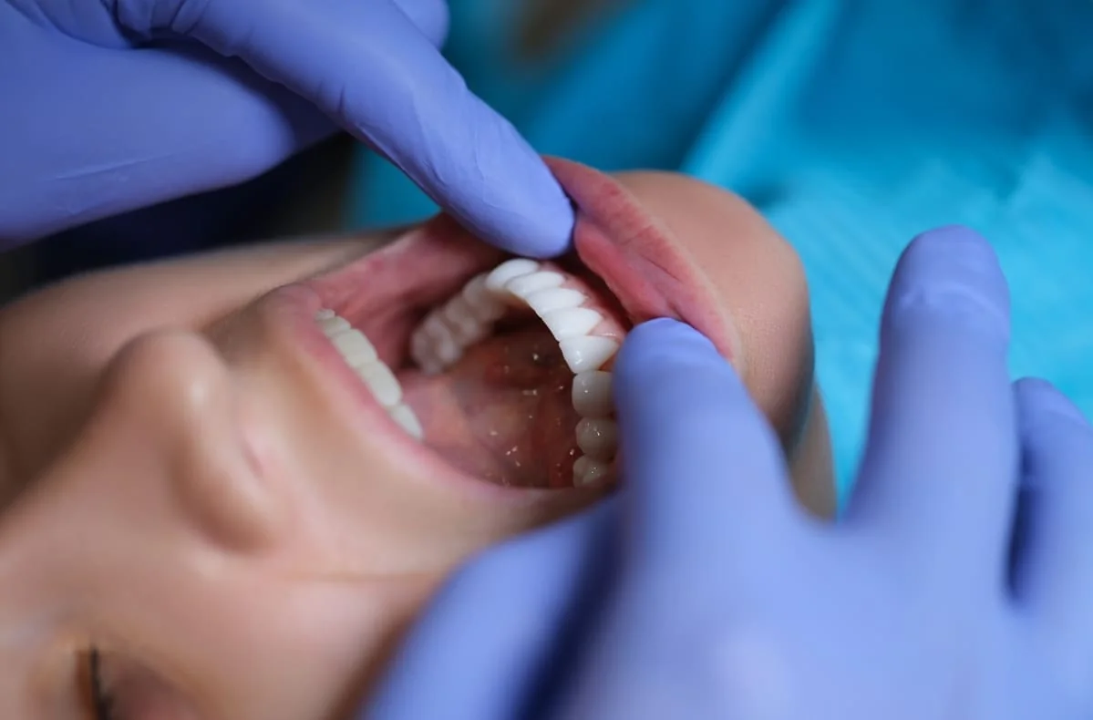 consult stomatologic in sarcina consult stomatologic in sarcina