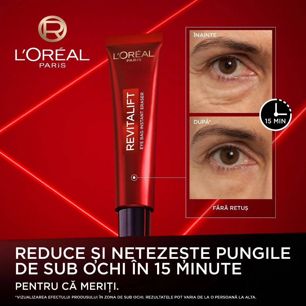 Crema corectoare pentru zona ochilor Revitalift Laser, 15ml, L'Oreal Paris