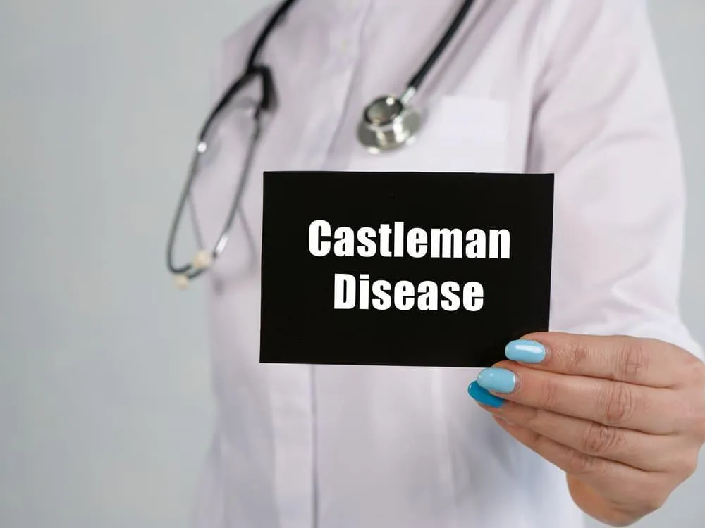 Boala Castleman: cauze, simptome, tratament